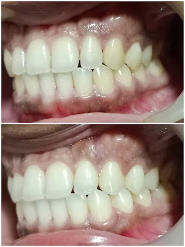 Pooja Smile Care Dental Gallery Image 23